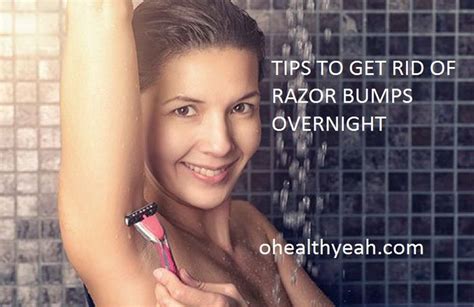 How To Get Rid Of Razor Bumps Fast Overnight Learn To Avoid Ingrown