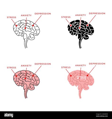 The Human Brain Is Prone To Stress Anxiety And Depression Vector
