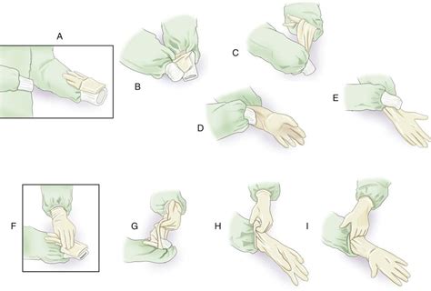Aseptic procedures are used in microbiology. Aseptic Techniques | Radiology Key