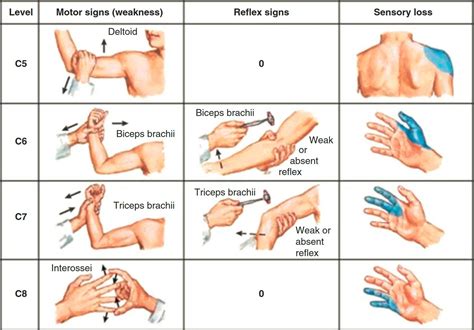 Physio Meets Science On Twitter Cervical Dermatomes And Myotomes The