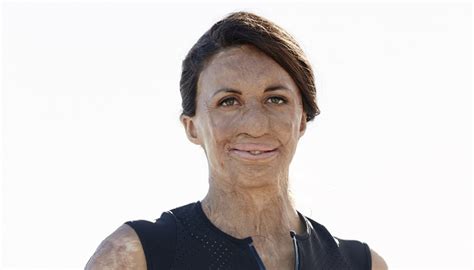 Turia Pitt When You Have The Right Mindset Anything Is Possible HRD Australia