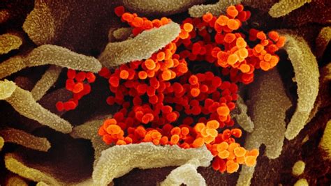 Sabtu, 15 februari 2020 14:48 wib 15 februari 2020, 14 terkait warna virus di gambar ini, peneliti memakai pemindaian warna palsu untuk menunjukan. Mengintip Wujud Virus Corona COVID-19 Dari Mikroskop