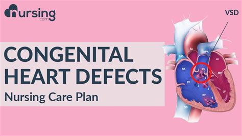 What Is A Congenital Heart Defect And How Do You Care For It Nursing