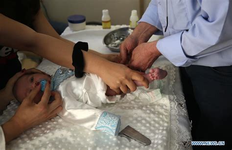 In Pics Circumcision Ceremony Of Eight Day Samaritan Baby Xinhua