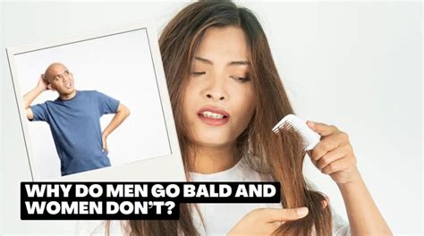Why Do Men Go Bald And Women Dont Stages Of Balding