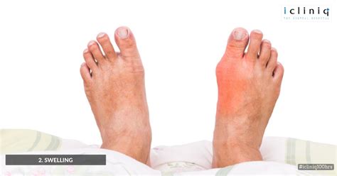 Sign Of Bone Cancer In Foot Health Feed Health Tips Fitness Tips And