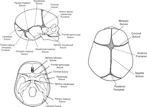 Computerized Tomography Of Cranial Sutures In Journal Of Neurosurgery