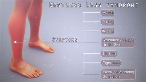 Restless Legs Syndrome Shown And Explained Using A Medical Animation