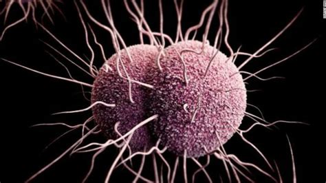 Gonorrhea Drug Resistance This Std Could Get Harder To Treat
