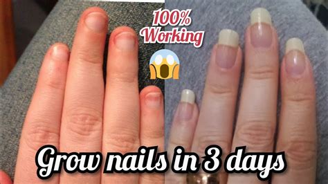 How To Grow Nails Fast Super Fast Nails Growth Tips Youtube