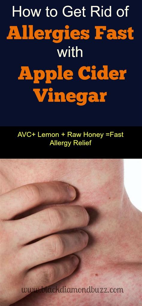 How To Use Apple Cider Vinegar For Skin Allergy And Get Fast Allergy