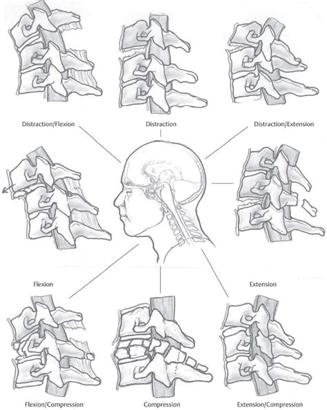 The Cervical Spine Radiology Key