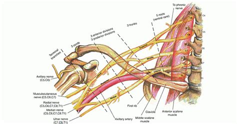 Brachial Plexus Nerve Block