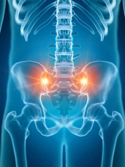 Sacroiliac Joint Paindysfunction Scottsdale Az Orthopedic Spine Surgery Images And Photos Finder