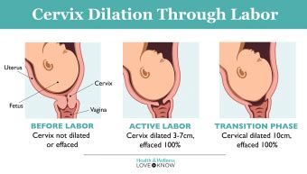 What Does A Dilated Cervix Look Like Lovetoknow