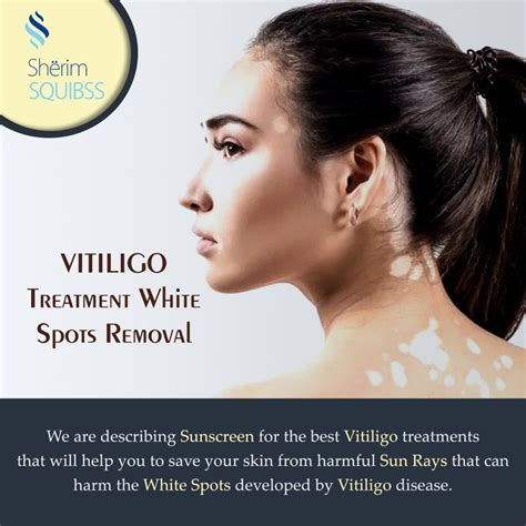 Vitiligo Treatment White Spots Removal Vitiligo Is A Skin Disease