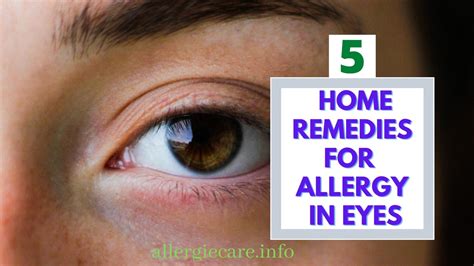 Best 5 Home Remedies For Allergy In Eyes Allergie Care