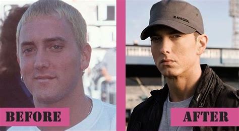 Eminem Before And After Plastic Surgery 06 Celebrity Plastic Surgery