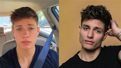 Matt Rife Has Been At The Center Of Plastic Surgery Speculations Ever