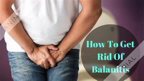 How To Get Rid Of Balanitis Youtube