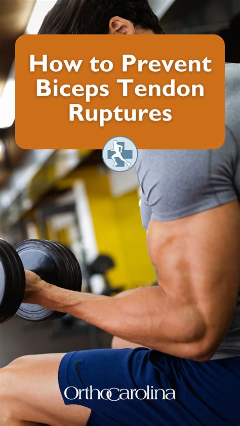 How To Prevent Biceps Tendon Ruptures In 2022 Bicep Tendonitis