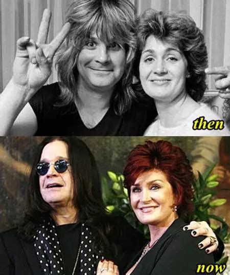 Ozzy Osbourne Plastic Surgery Before And After