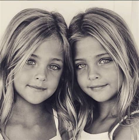 Leah Rose Och Ava Marie Kallas För Världens Vackraste Tvillingar
