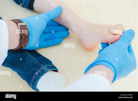 Child Joint Dislocation Or Luxation Healing The Foot Doctor Examining