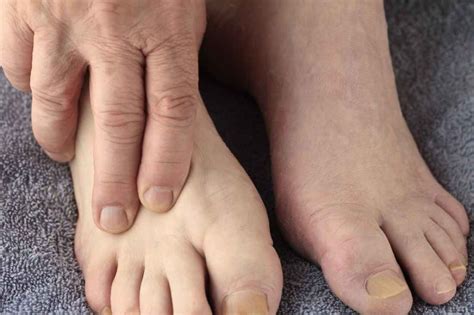 Best Diabetic Slippers For Men With Swollen Feet August 2021 Update