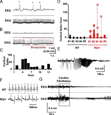 Leaky RyR2 channels unleash a brainstem spreading depolarization mechanism of sudden cardiac 