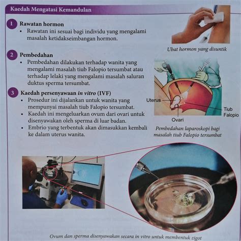 Kaedah mengatasi kemandulan 1) rawatan hormon 2) pembedahan 3). Kemandulan; Apa Punca dan Kaedah Mengatasinya?