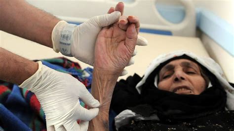 Yemen Cholera Cases Pass 100000 Amid Unprecedented Epidemic Bbc News