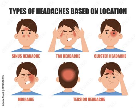 Types Of Headache Based On Location Vector Isolated Pain In Different