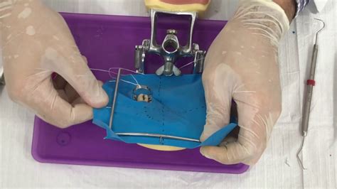 Material Para Isolamento Absoluto