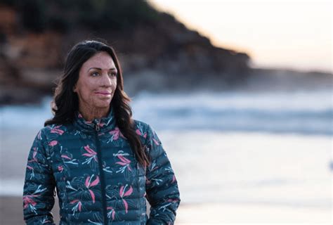 Bushfire Survivor Turia Pitt Launches Social Campaign For Businesses