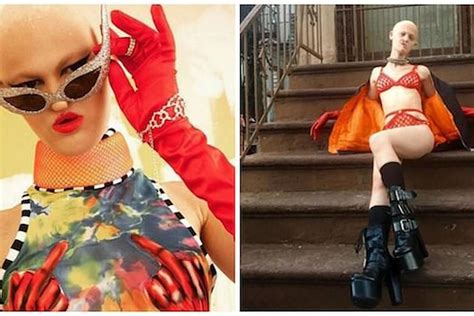 Meet Melanie Gaydos The Model With A Rare Genetic Disorder Taking Over The Fashion World