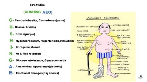 Cushing Syndrome Cushings Syndrome Gynecomastia Hypercortisolism
