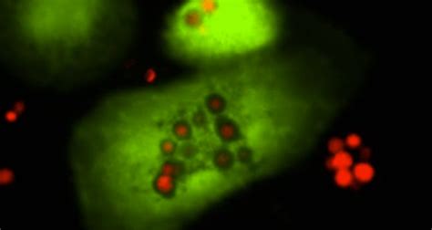 Study Unravels How Our Immune System Deals With Fungal And Viral Infections