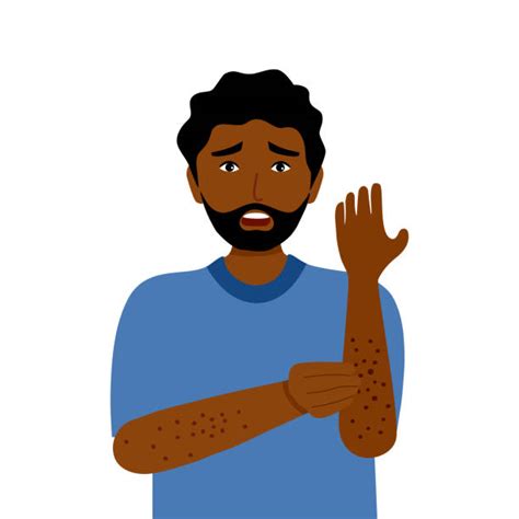 Black Person Itching Skin Illustrations Royalty Free Vector Graphics