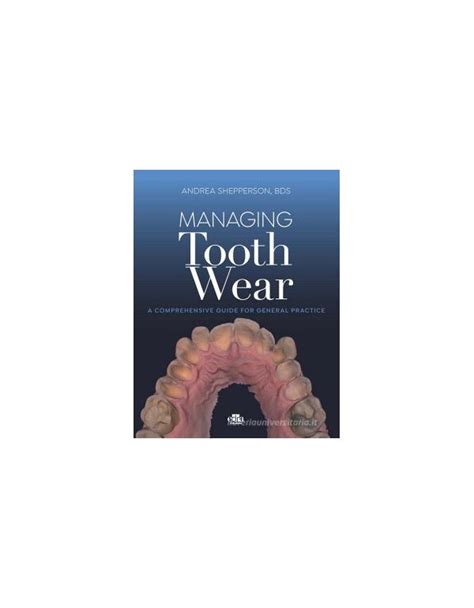 Managing Tooth Wear A Comprehensive Guide For General Practice