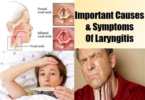 Important Causes And Symptoms Of Laryngitis Malade