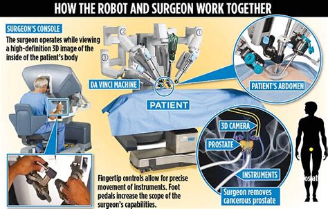 The Robot That Could Cure Your Prostate Cancer Daily Mail Online