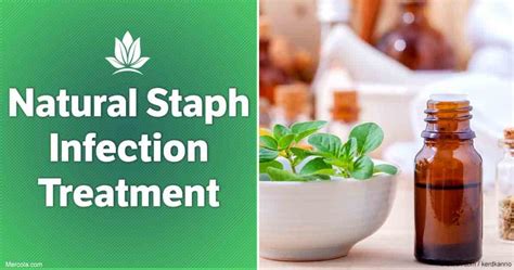 Staph Infection Top 10 Home Remedies And Natural Treatments