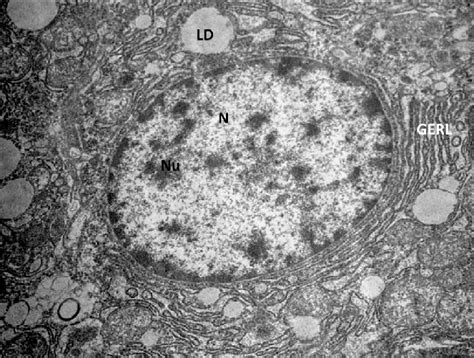 We did not find results for: Transmission Electron micrograph section of control liver ...