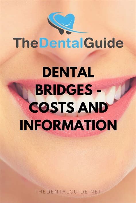 Dental Bridges Costs And Information The Dental Guide
