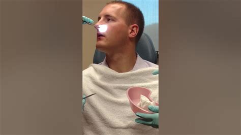 Septoplasty And Turbinate Reduction Splint Removal Youtube