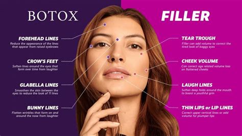 Botox And Filler What Fits For You Outer Banks Dermatology Board