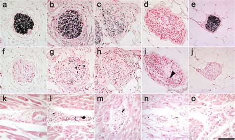 a -Synuclein and tyrosine hydroxylase (TH) immunostaining ...