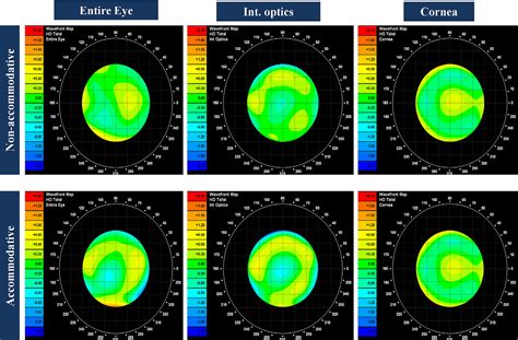 Figure 1 From Changes In Ocular Wavefront Aberrations And Retinal Image