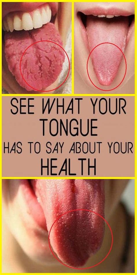 look at your tongue and see what it has to say about your health free remedies health
